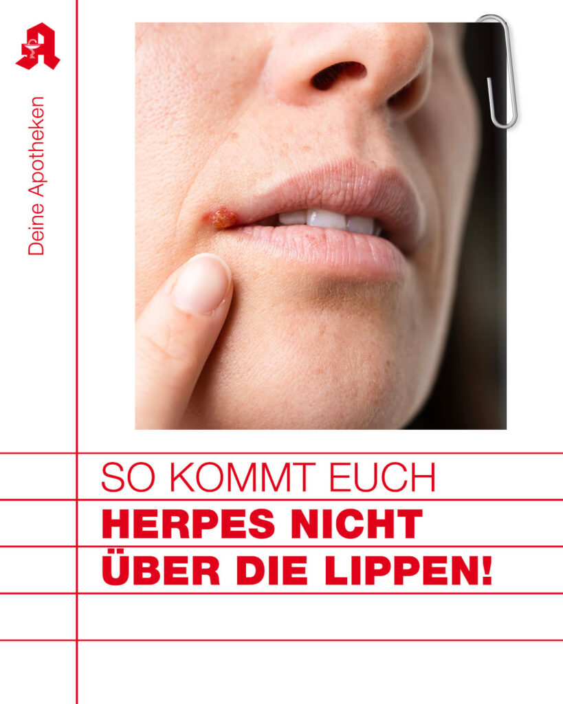 Herpes vermeiden